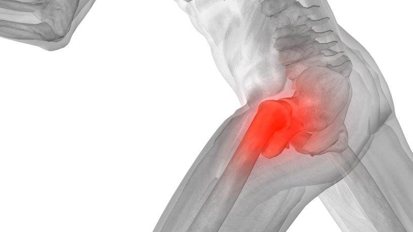 Hip joint pain